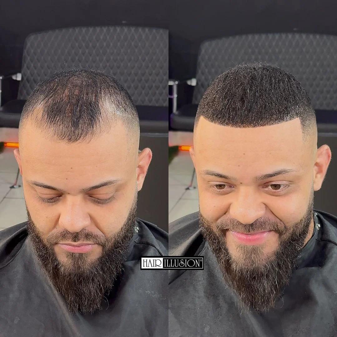 Before and after 6